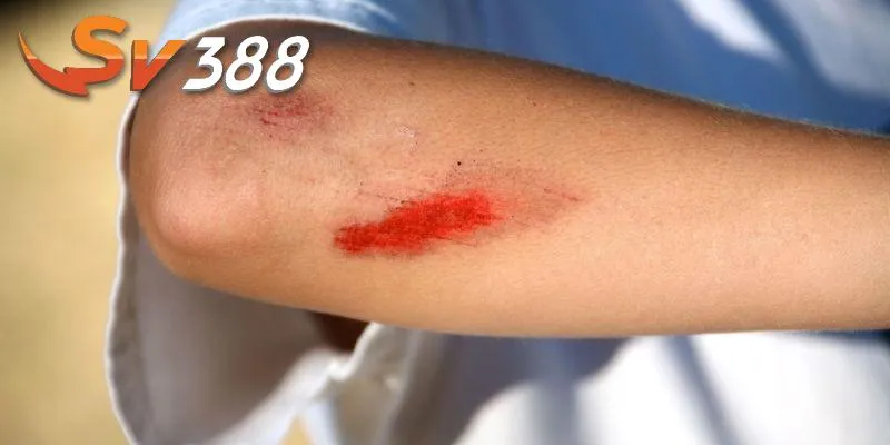 Mơ thấy máu có nhiều mối liên kết